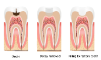 Lignum Dental