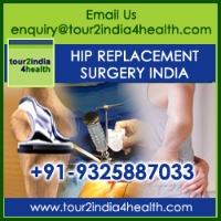 Hip Replacement Surgery Cost In India