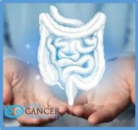 low Cost of Colon Cancer Treatment India