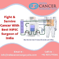 Low Cost HIPEC Operation India